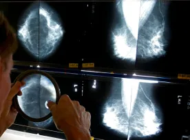 Leaked emails show Sask. breast cancer patients can’t afford Calgary for care