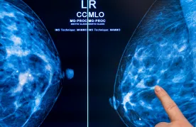 ‘We’re just a number’: Advocates call on Nova Scotia to reassess breast-screening policy