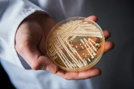 Deadly, drug-resistant fungus spreading at ‘alarming rate,’ CDC warns