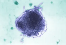Measles can ‘erase’ your immune system’s memory. Here’s how