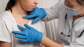 Another state confirms measles case with infected child its first of year