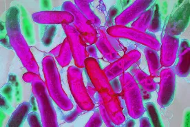 Why are young adults getting colorectal cancer? E. coli may be a clue