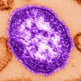 Provinces warns of measles exposure at Dugald school
